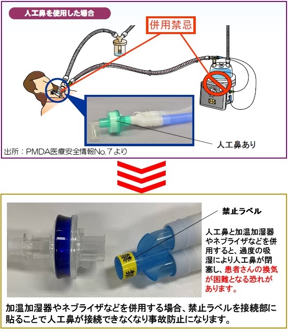 禁止標(biāo)簽 人工鼻誤裝到使用加濕器等的人工呼吸機(jī)上的警示標(biāo)簽